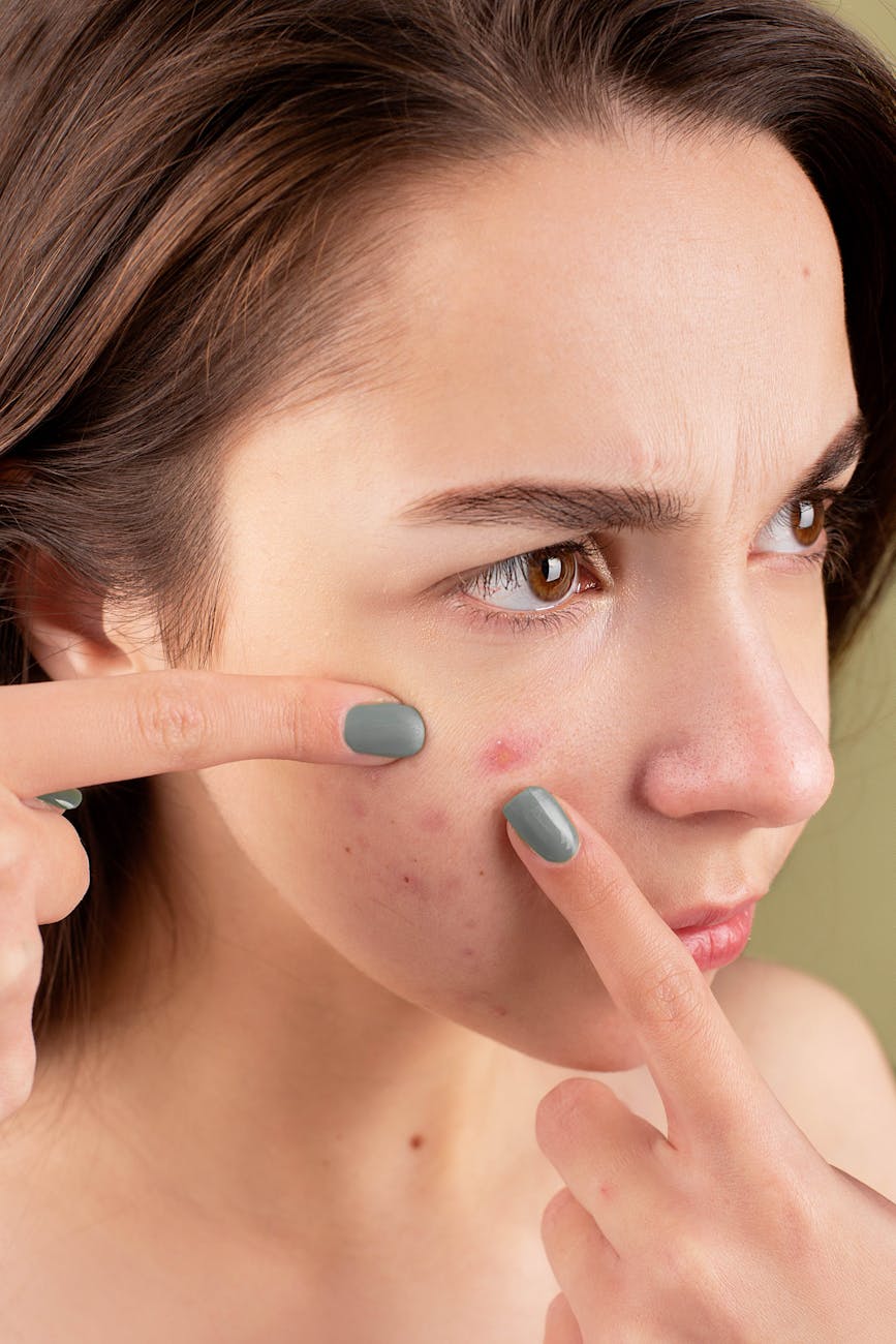 Discover 10 effective home remedies and understand the causes of acne, eczema, and psoriasis. Learn how to achieve clear skin naturally and improve your overall skin health with these simple tips.